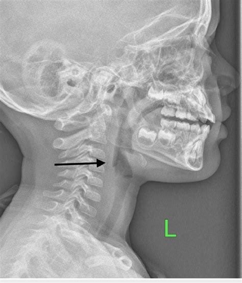 soft tissue radiography 